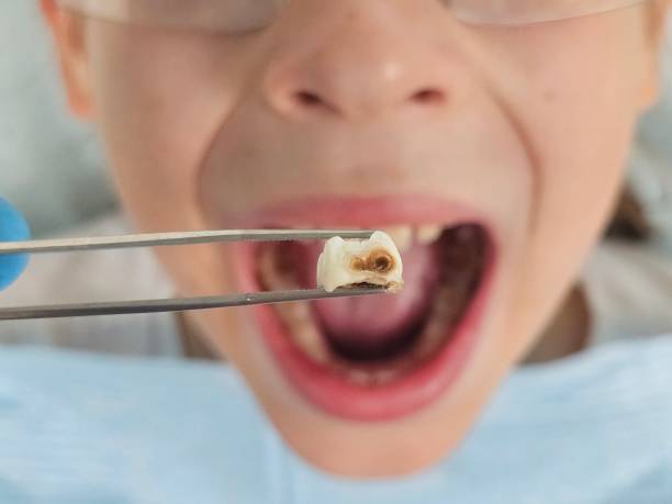 Dentist for Dental Trauma in NH