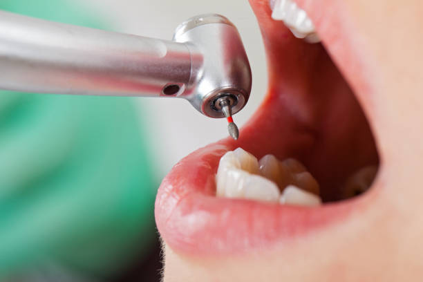 Best Dentist for Severe Toothache  in Rochester, NH